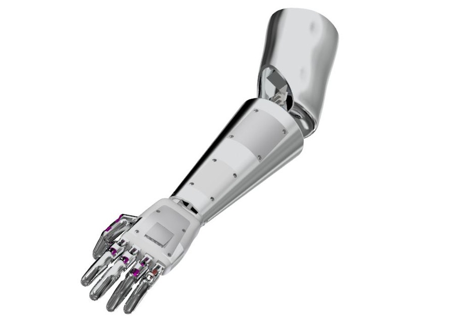 Robot arm