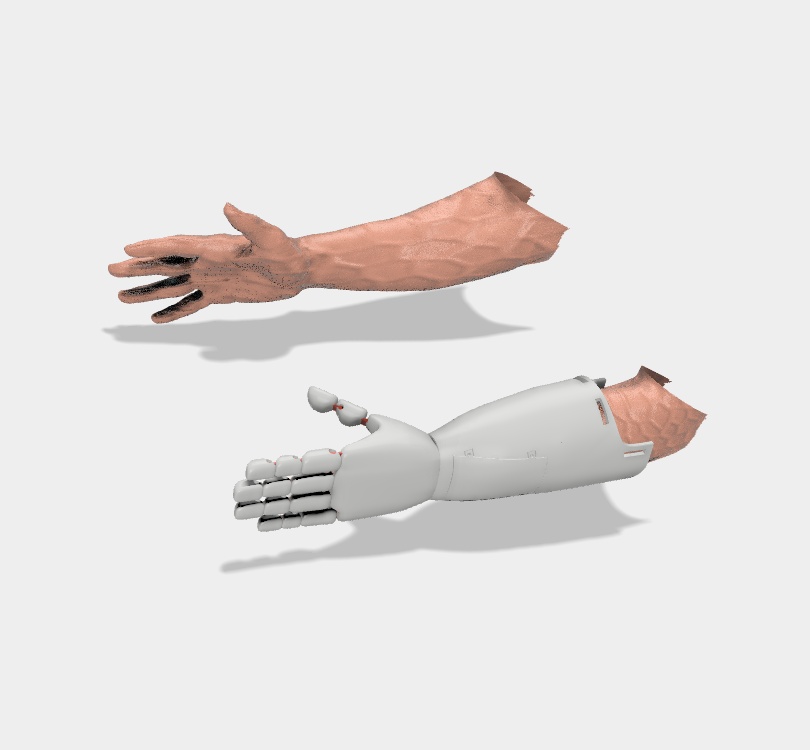 LOW COST ROBOTIC PROSTHESIS FROM LEFT HAND TO FOREARM - PROTESIS ROBOTICA DE MANO HASTA ANTEBRAZO IZQUIERDO DE BAJO COSTO