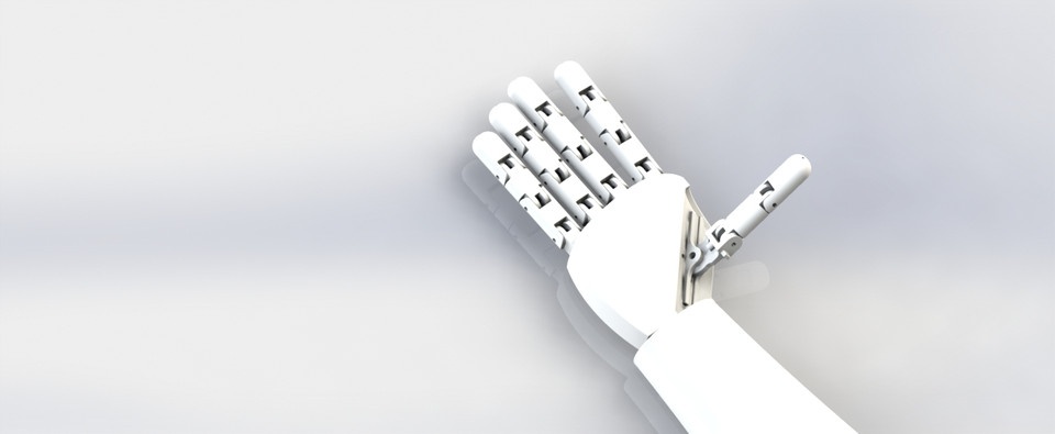 Prosthetic arm