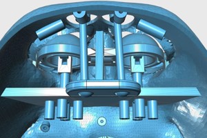 DARA Robot eyes - InMoov Advanced Eyes