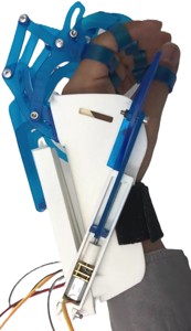2 UNITS - ELECTRONIC BOTH HAND EXOSKELETON FOR MEDICAL REHABILITATION - EXOESQUELETO ELECTRONICO AMBAS MANOS PARA REHABILITACION MEDICA