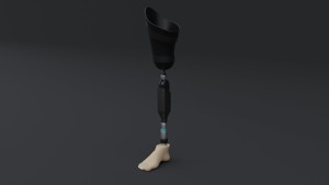 Above-Knee Prosthetic Leg