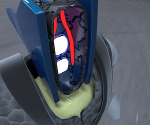 Robot