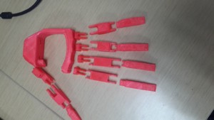 HAND PROSTHESIS