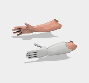 LOW COST ROBOTIC PROSTHESIS FROM LEFT HAND TO FOREARM - PROTESIS ROBOTICA DE MANO HASTA ANTEBRAZO IZQUIERDO DE BAJO COSTO