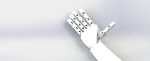 Prosthetic arm
