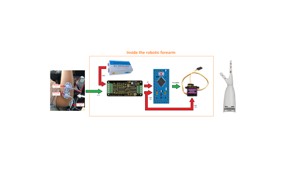 COMPLETE LOW-COST ROBOTIC PROSTHESIS SOLUTION FROM RIGHT HAND TO FOREARM, EMG MYOELELECTRIC SENSOR AND ARDUINO FIRMWARE